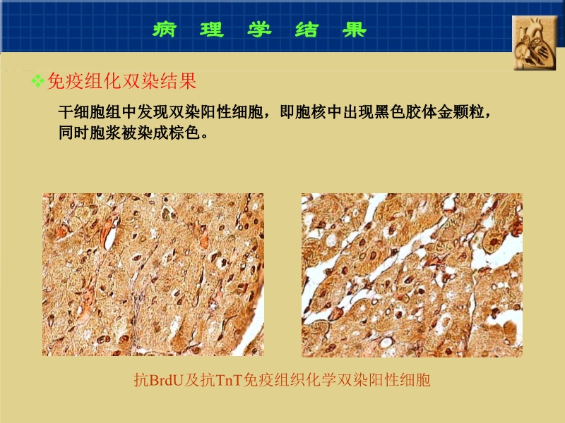 072010382251_02005-09-06干细胞与心肌细胞再生_7.jpg