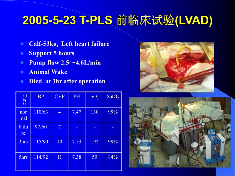 072010433259_02005-12-10机械辅助循环治疗围手术期心衰的临床体会_6.jpg