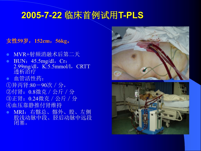 072010433259_02005-12-10机械辅助循环治疗围手术期心衰的临床体会_8.jpg