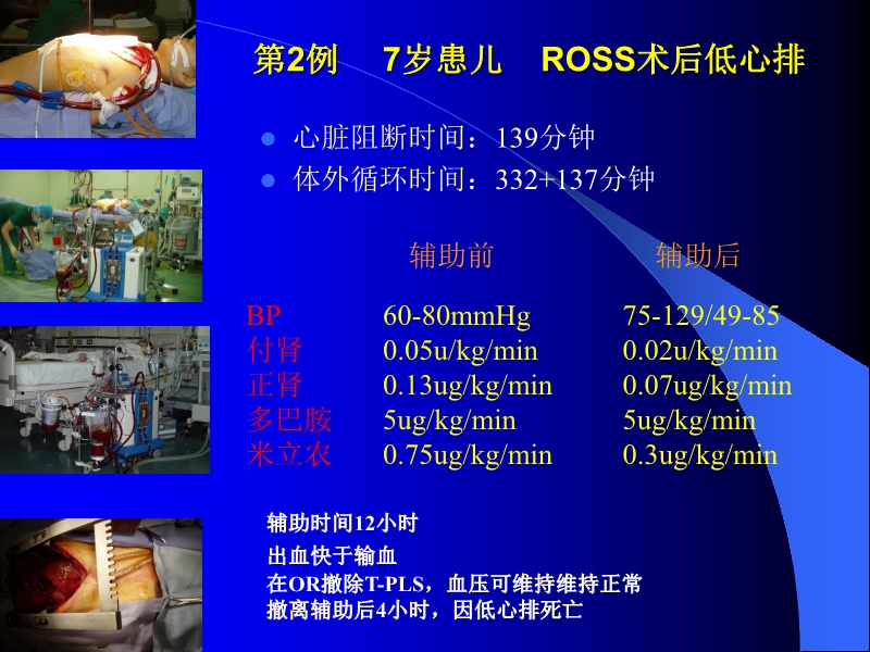 072010433259_02005-12-10机械辅助循环治疗围手术期心衰的临床体会_10.jpg