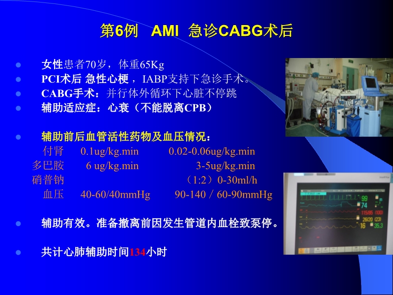 072010433259_02005-12-10机械辅助循环治疗围手术期心衰的临床体会_16.jpg