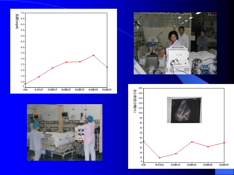 072010433259_02005-12-10机械辅助循环治疗围手术期心衰的临床体会_17.jpg