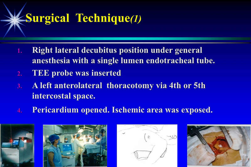 072010544493_0vascularizationin94PatientswithCAD亚洲心血管外科会议-日本_6.jpg