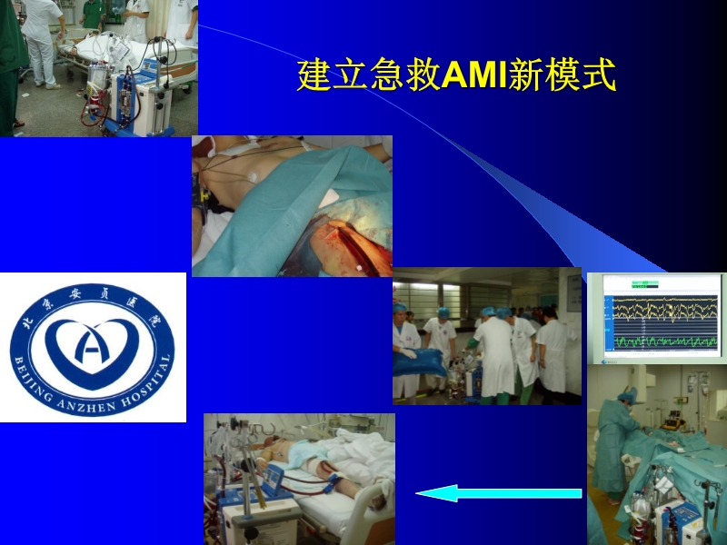 072011010455_02006-11-17应用T-PLS治疗围手术期心衰的临床体会_20.jpg