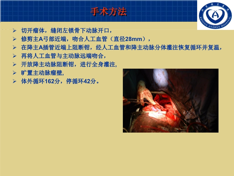 072011055676_02007-03-15巨大主动脉弓降部动脉瘤外科治疗(个例体会)_5.jpg