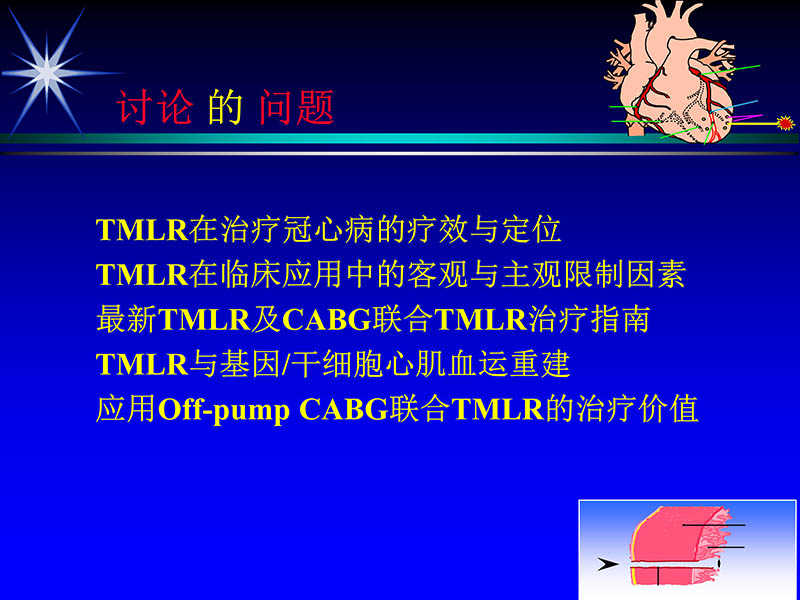 072011331246_02007-05-25当今tmlr的地位和价值_2.jpg