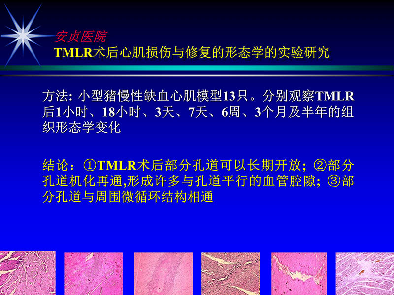 072011331246_02007-05-25当今tmlr的地位和价值_22.jpg