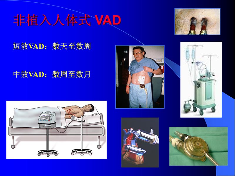 072811395715_02007-08-28机械辅助循环培训_17.jpg