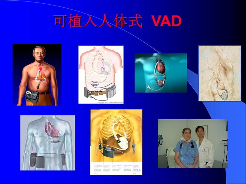 072811395715_02007-08-28机械辅助循环培训_25.jpg