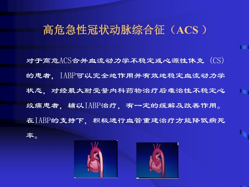 072812074688_02010-04-22主动脉内球囊反搏泵IABP的临床应用_24.jpg