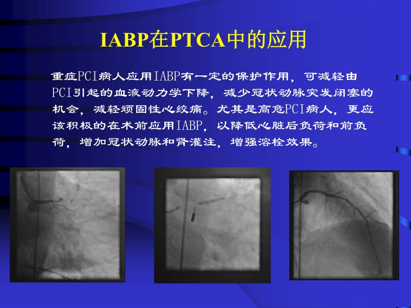 072812074688_02010-04-22主动脉内球囊反搏泵IABP的临床应用_27.jpg