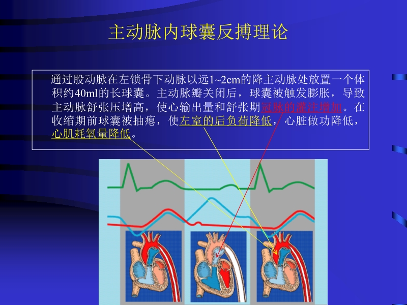 072812090405_02010-06-17现代机械辅助循环治疗心力衰竭_8.jpg