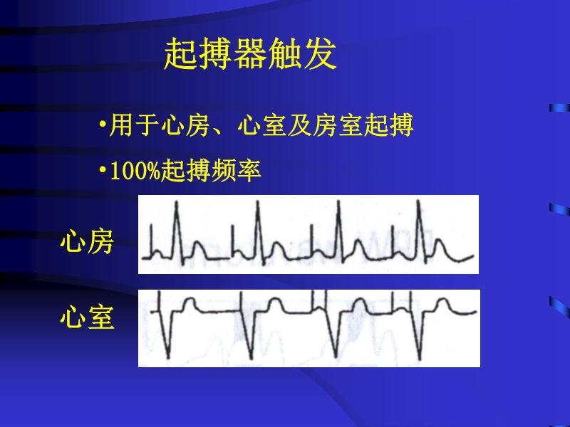 072812090405_02010-06-17现代机械辅助循环治疗心力衰竭_15.jpg