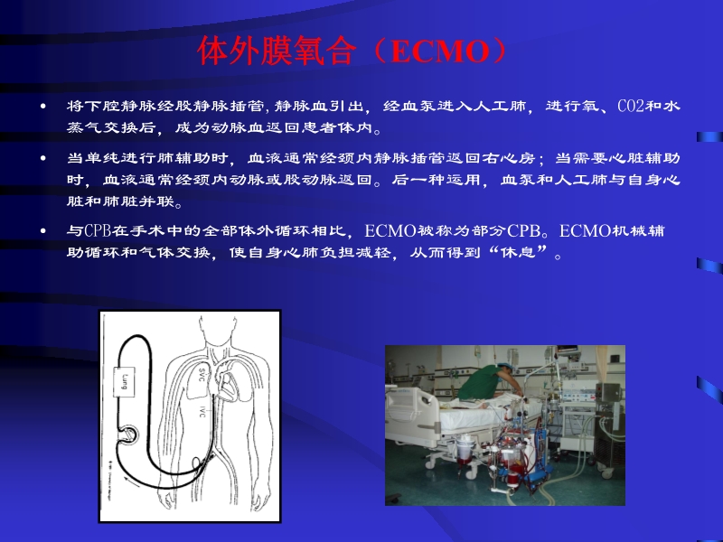 072812090405_02010-06-17现代机械辅助循环治疗心力衰竭_34.jpg