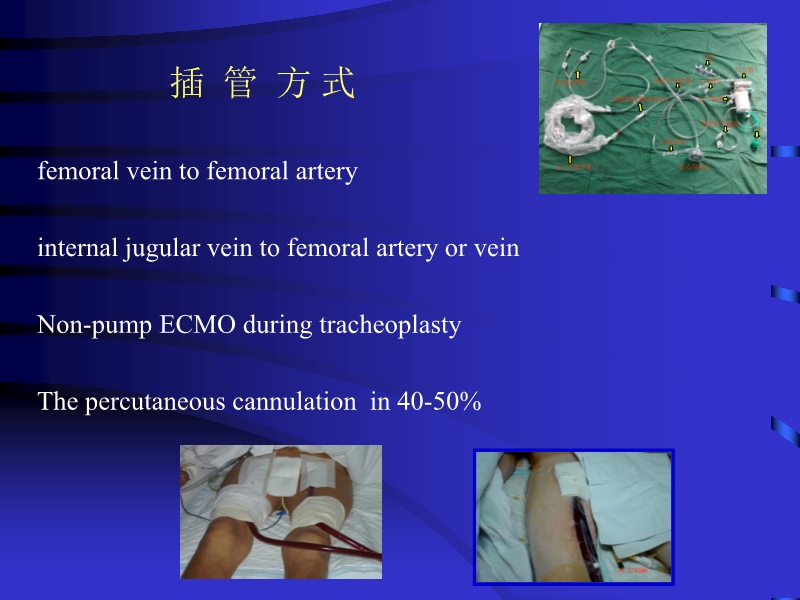 072812090405_02010-06-17现代机械辅助循环治疗心力衰竭_38.jpg