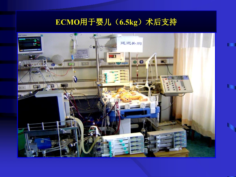 072812090405_02010-06-17现代机械辅助循环治疗心力衰竭_40.jpg