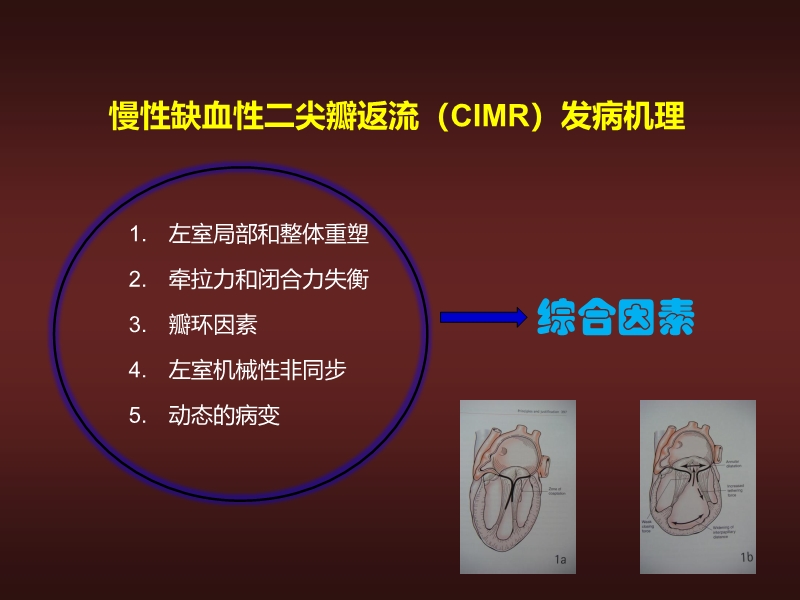 072812134128_02010-06-17心力衰竭的外科治疗_5.jpg