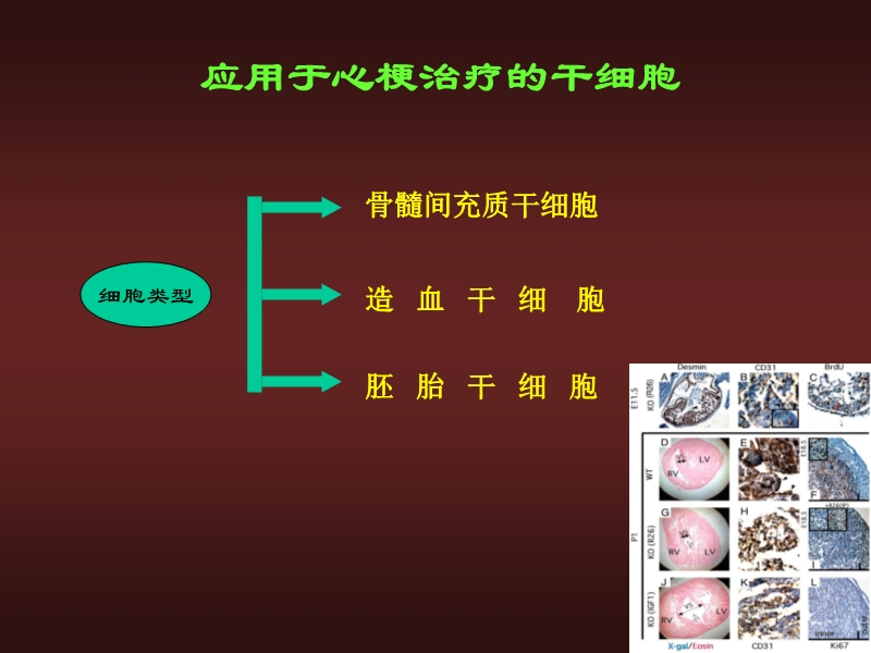 072812134128_02010-06-17心力衰竭的外科治疗_28.jpg