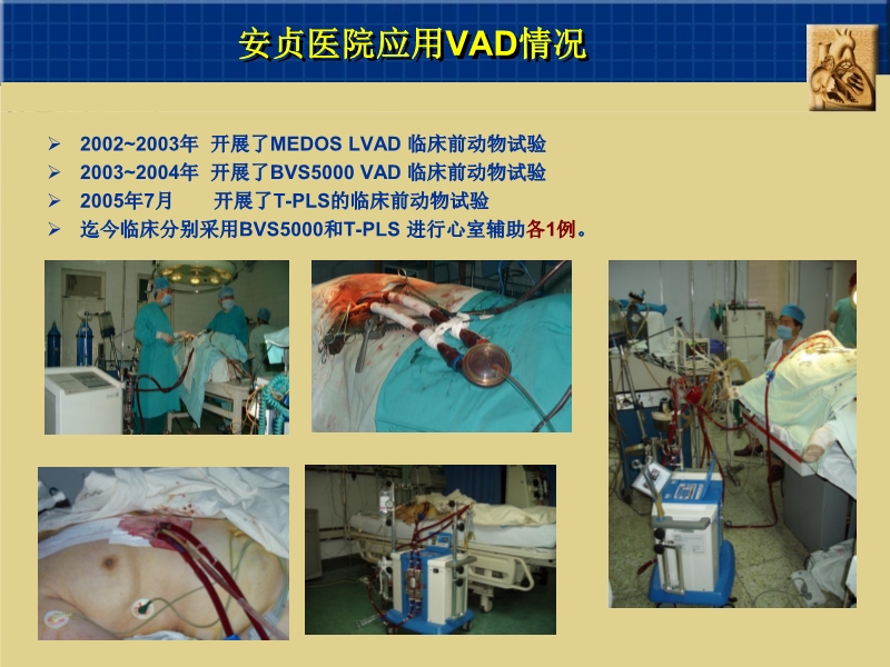 072812160890_02010-06-17心室辅助装置和人工心脏_29.jpg