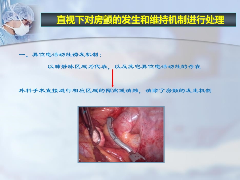 072812225579_02011-06-24其他微创外科消融方法治疗心房颤动的进展与现状_3.jpg