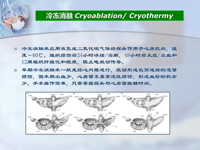 072812225579_02011-06-24其他微创外科消融方法治疗心房颤动的进展与现状_6.jpg