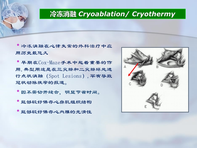072812225579_02011-06-24其他微创外科消融方法治疗心房颤动的进展与现状_7.jpg