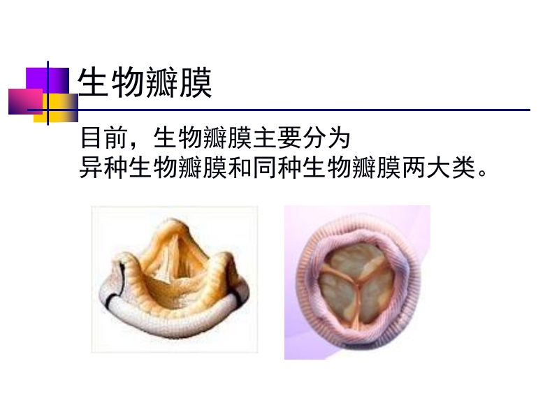 072812552022_02011-12-05人工心脏瓣膜_15.jpg