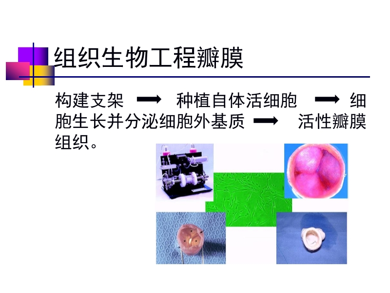 072812552022_02011-12-05人工心脏瓣膜_36.jpg