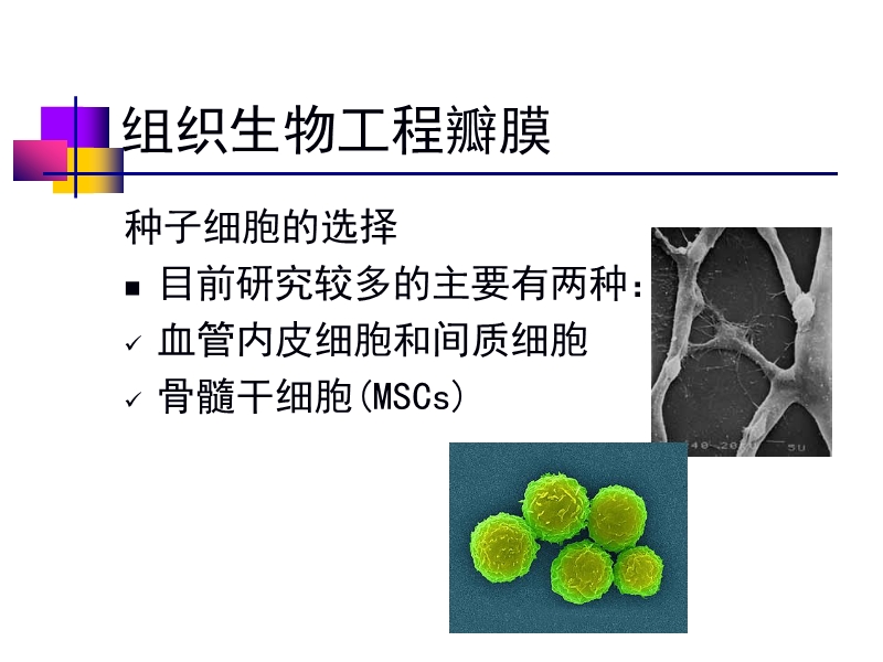 072812552022_02011-12-05人工心脏瓣膜_41.jpg