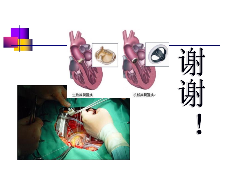 072812552022_02011-12-05人工心脏瓣膜_46.jpg