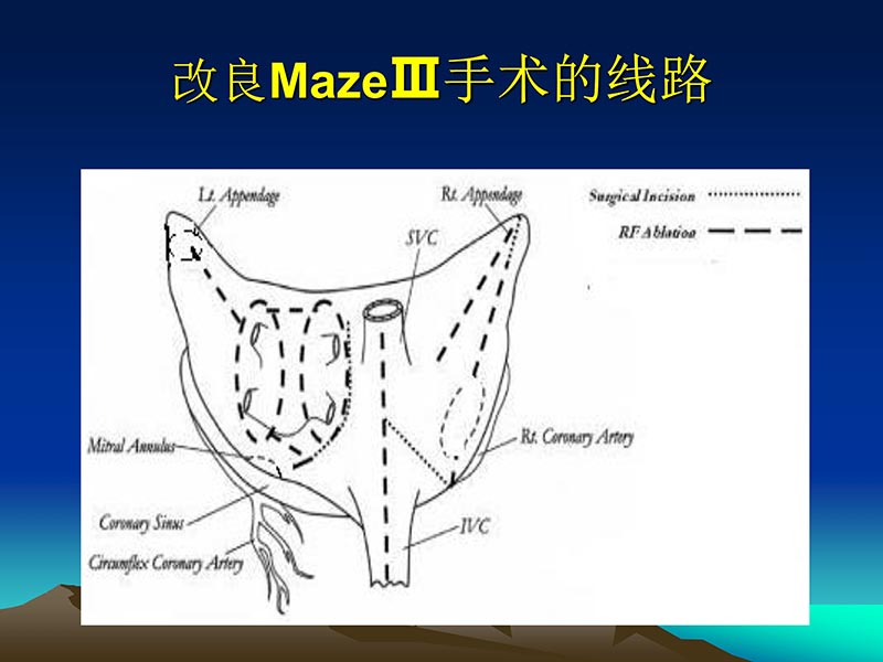 072812565383_02011-12-05心脏瓣膜外科的发展与现状_63.jpg
