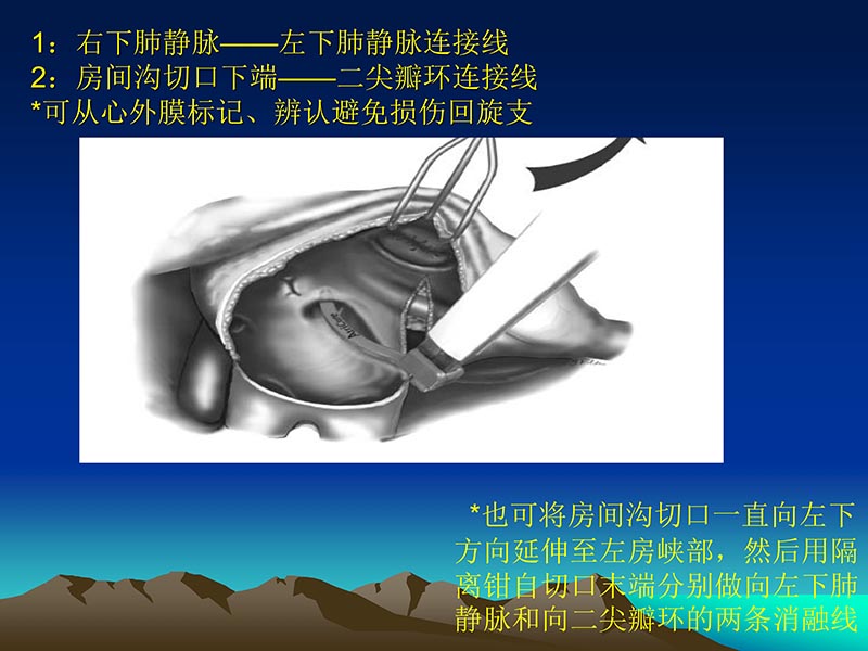 072812565383_02011-12-05心脏瓣膜外科的发展与现状_68.jpg