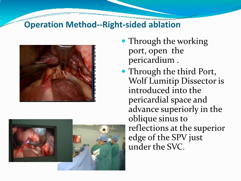 072812245451_0uencyAblationforAtrialFibrillation亚洲心血管外科会议-印尼_6.jpg
