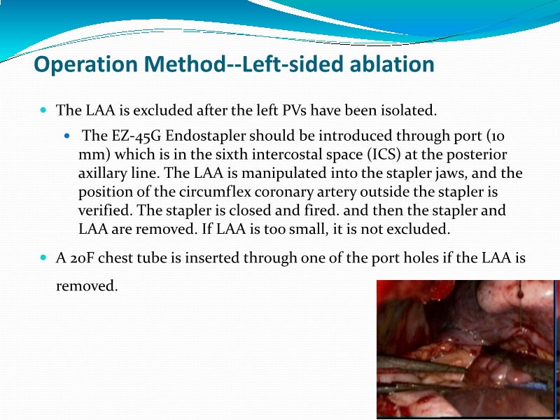 072812245451_0uencyAblationforAtrialFibrillation亚洲心血管外科会议-印尼_9.jpg