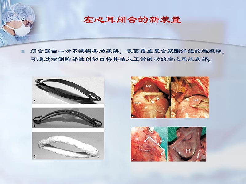 072812262445_02012-04-22微创外科治疗心房颤动_22.jpg