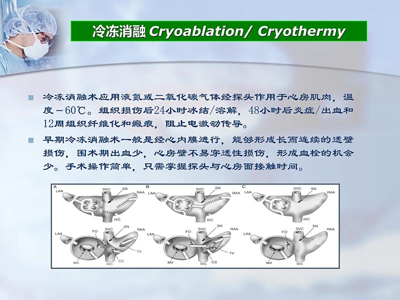 072812262445_02012-04-22微创外科治疗心房颤动_28.jpg