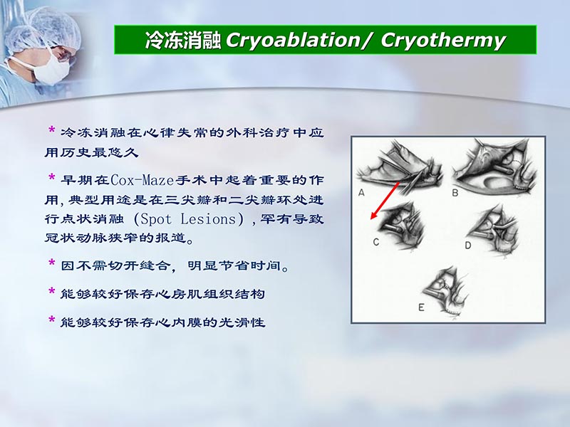 072812262445_02012-04-22微创外科治疗心房颤动_29.jpg