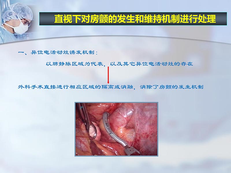 072812262445_02012-04-22微创外科治疗心房颤动_49.jpg