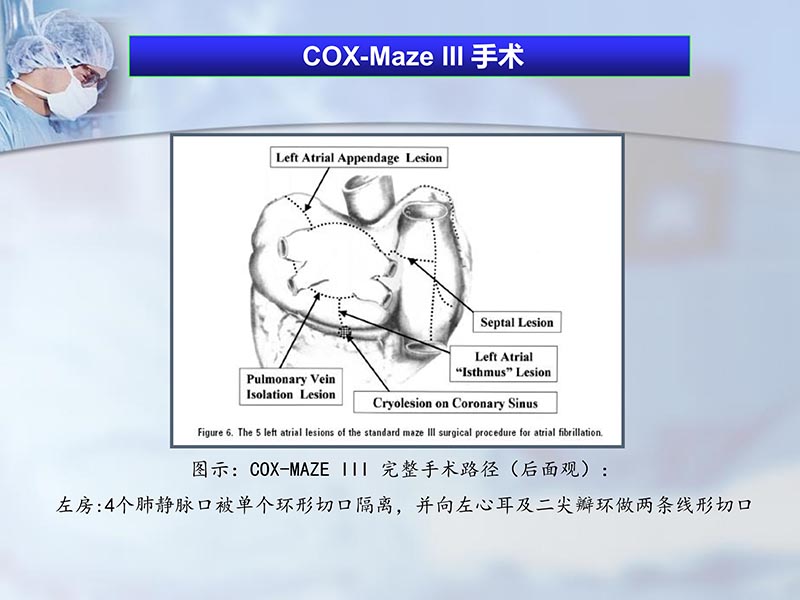 072812295126_02012-06-23外科治疗心房颤动的历史与现状_6.jpg