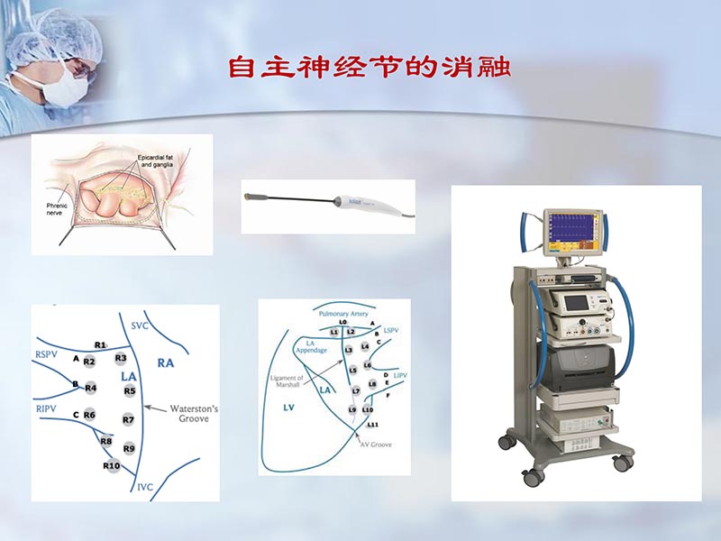 072812295126_02012-06-23外科治疗心房颤动的历史与现状_25.jpg