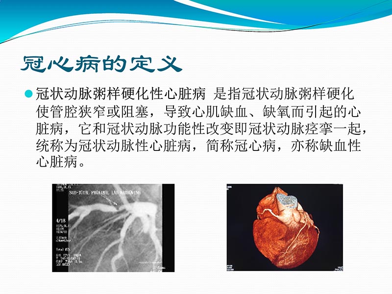 072813401993_02013-03-06微创冠状动脉搭桥治疗缺血性心脏病_3.jpg
