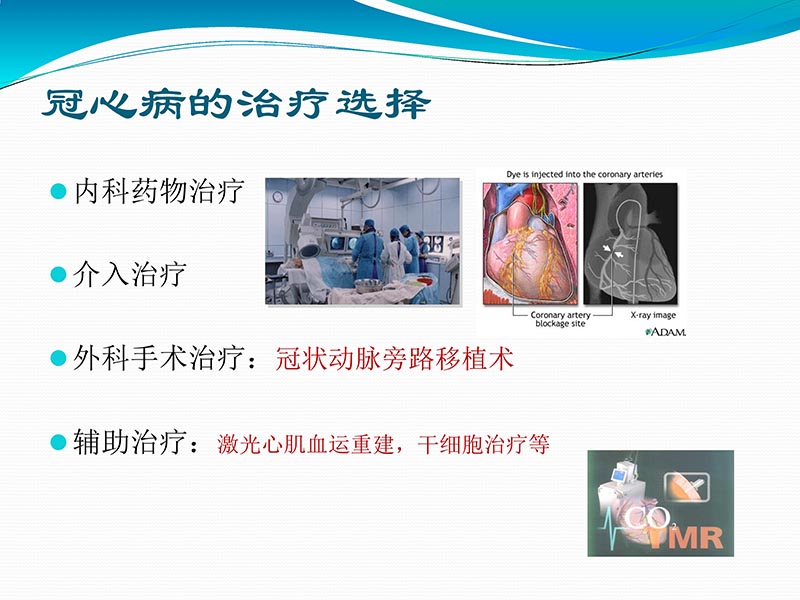 072813401993_02013-03-06微创冠状动脉搭桥治疗缺血性心脏病_5.jpg