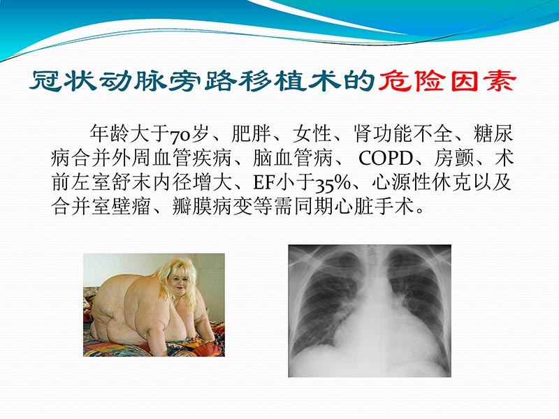 072813401993_02013-03-06微创冠状动脉搭桥治疗缺血性心脏病_11.jpg