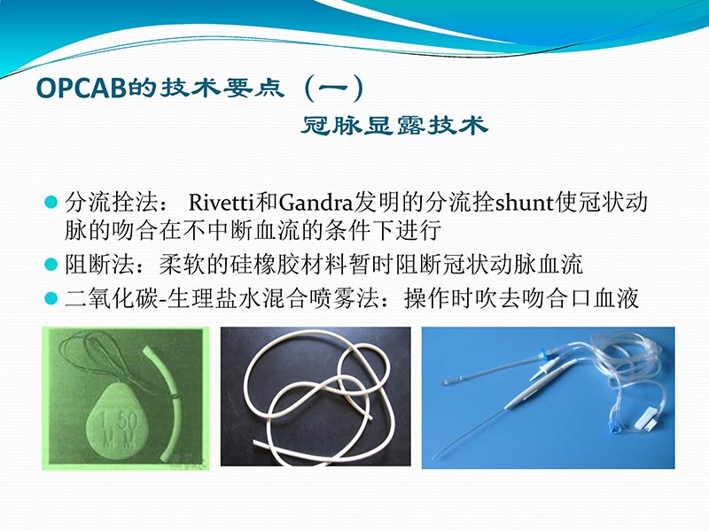 072813401993_02013-03-06微创冠状动脉搭桥治疗缺血性心脏病_22.jpg
