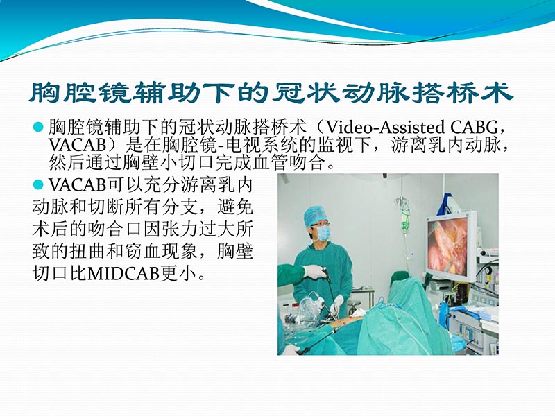 072813401993_02013-03-06微创冠状动脉搭桥治疗缺血性心脏病_38.jpg