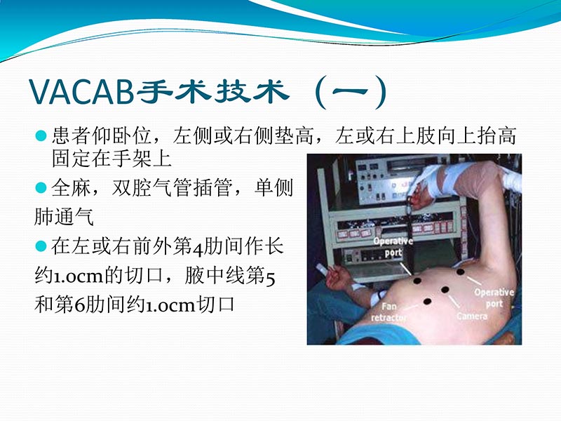 072813401993_02013-03-06微创冠状动脉搭桥治疗缺血性心脏病_40.jpg