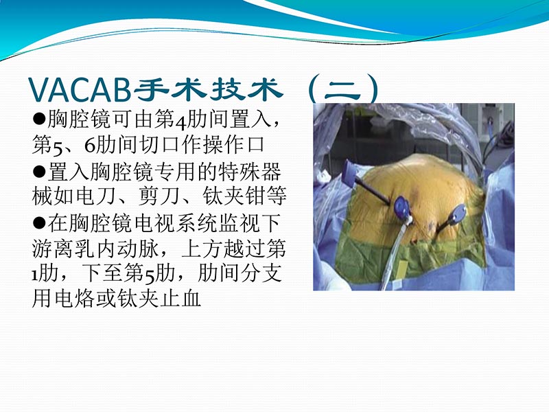072813401993_02013-03-06微创冠状动脉搭桥治疗缺血性心脏病_41.jpg