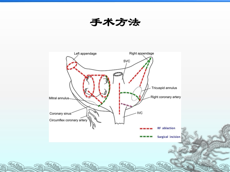 072814321069_02013-07-23心脏瓣膜手术同期行术中双极射频消融治疗心房颤动_8.jpg