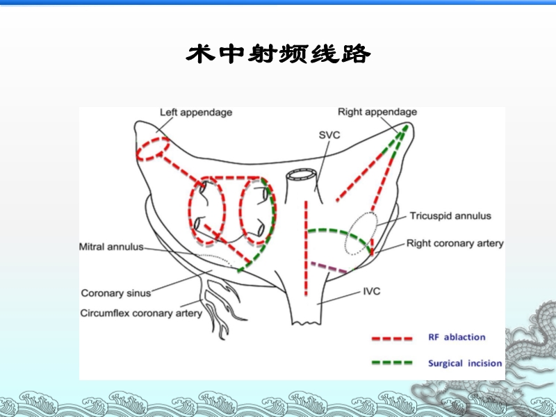 072814203565_02013-07-26心内外科携手并肩战房颤_7.jpg