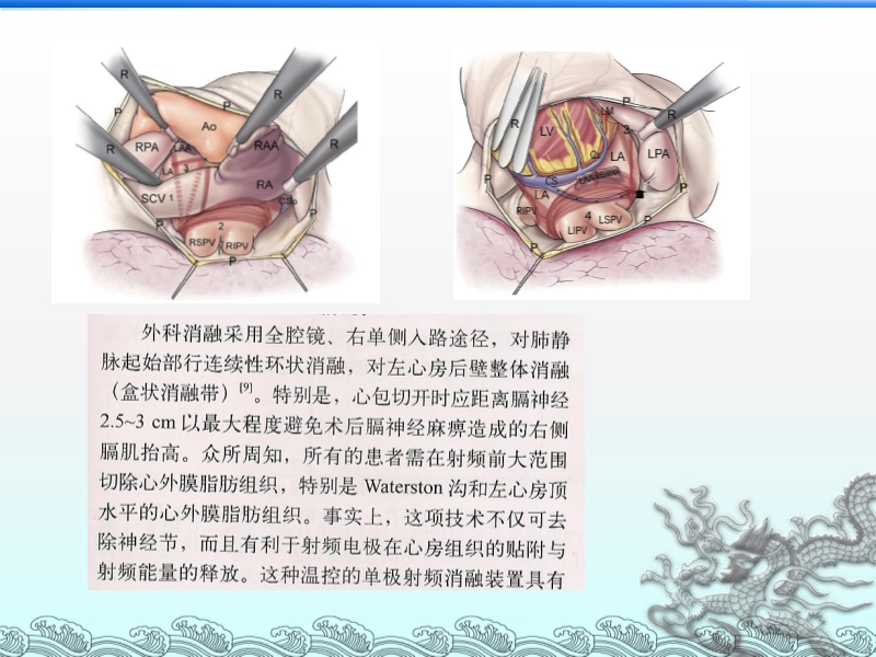072814203565_02013-07-26心内外科携手并肩战房颤_21.jpg